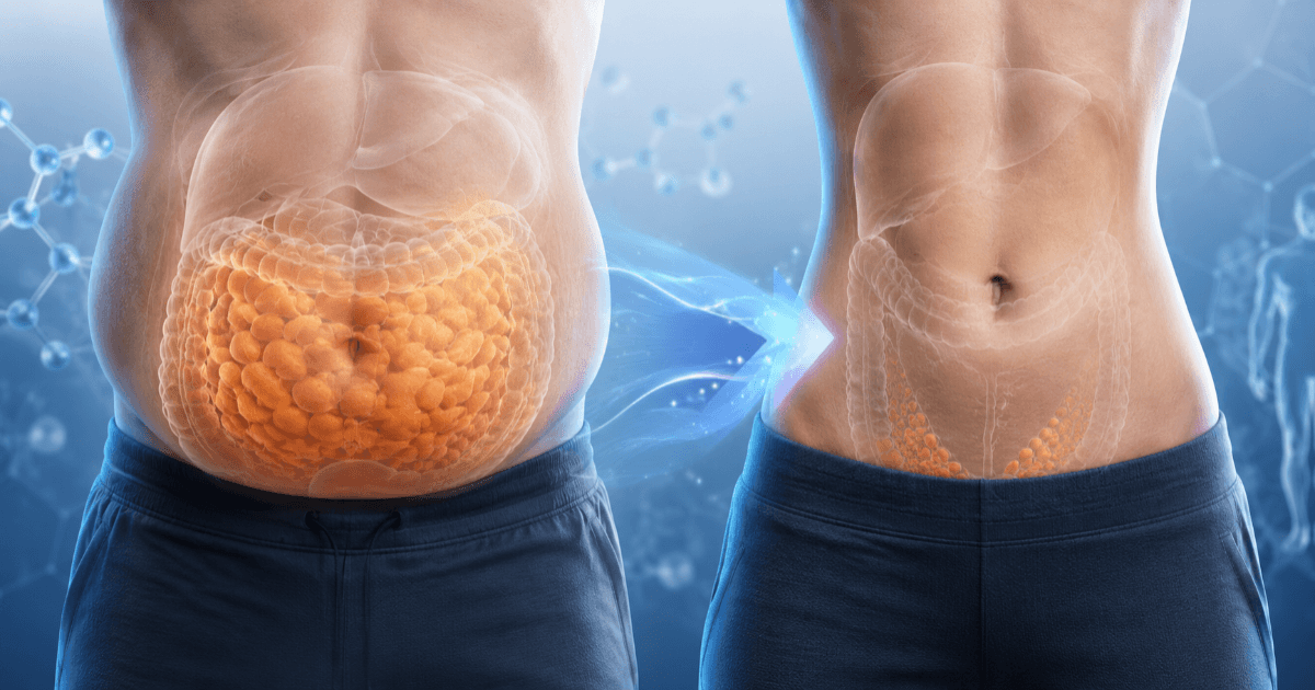 ¿Más que el peso, la "grasa dentro del abdomen"? La razón por la cual una reducción del 10% de la grasa visceral disminuye significativamente el riesgo de diabetes